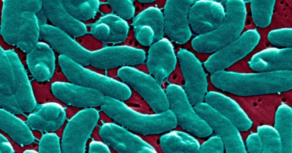 Here's who's at-risk after four die from flesh-eating bacteria in Florida