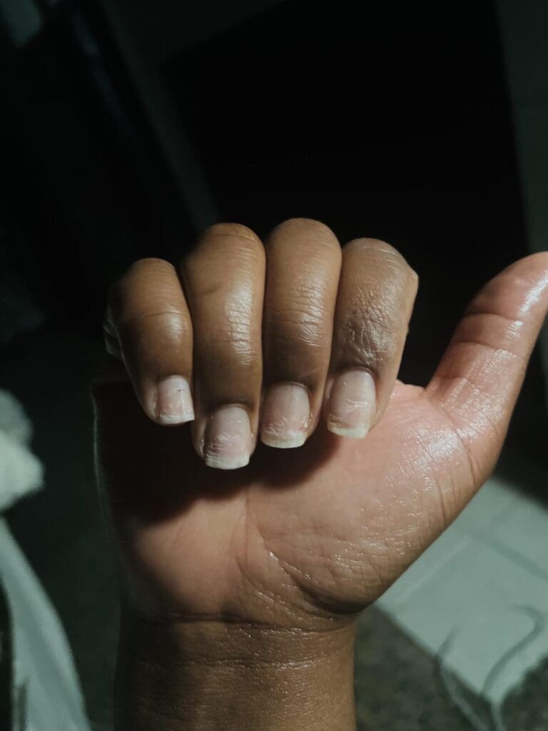 HEALING NAILS AFTER A GEL MANICURE